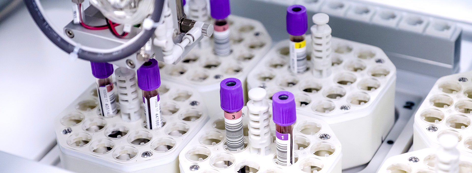 Test tubes in the laboratory on the automation track.