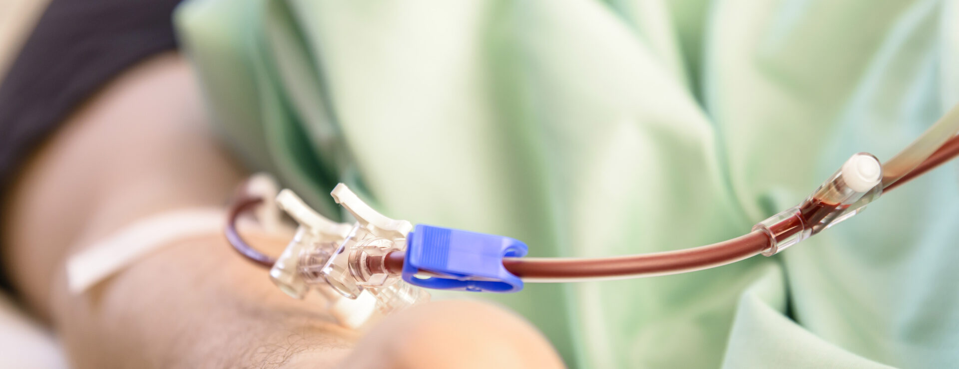 Kantasoluluovutus verenkierrosta, lähikuva.