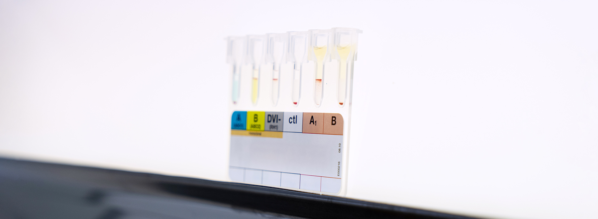 Review of red blood cell antibody screening on a light table.