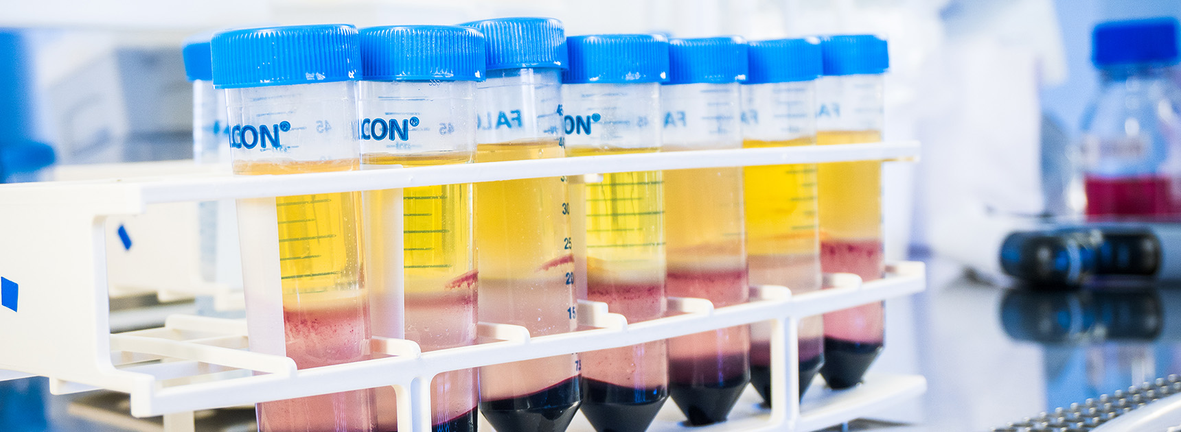 Veripalvelun biopankin verinäytteitä näyteputkissa.