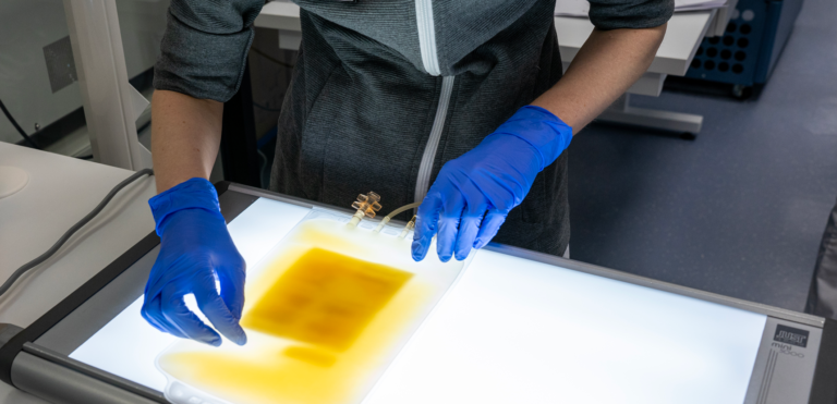 Veripalvelun työntekijä tarkastaa valopöydällä trombosyyttivalmistepussia.